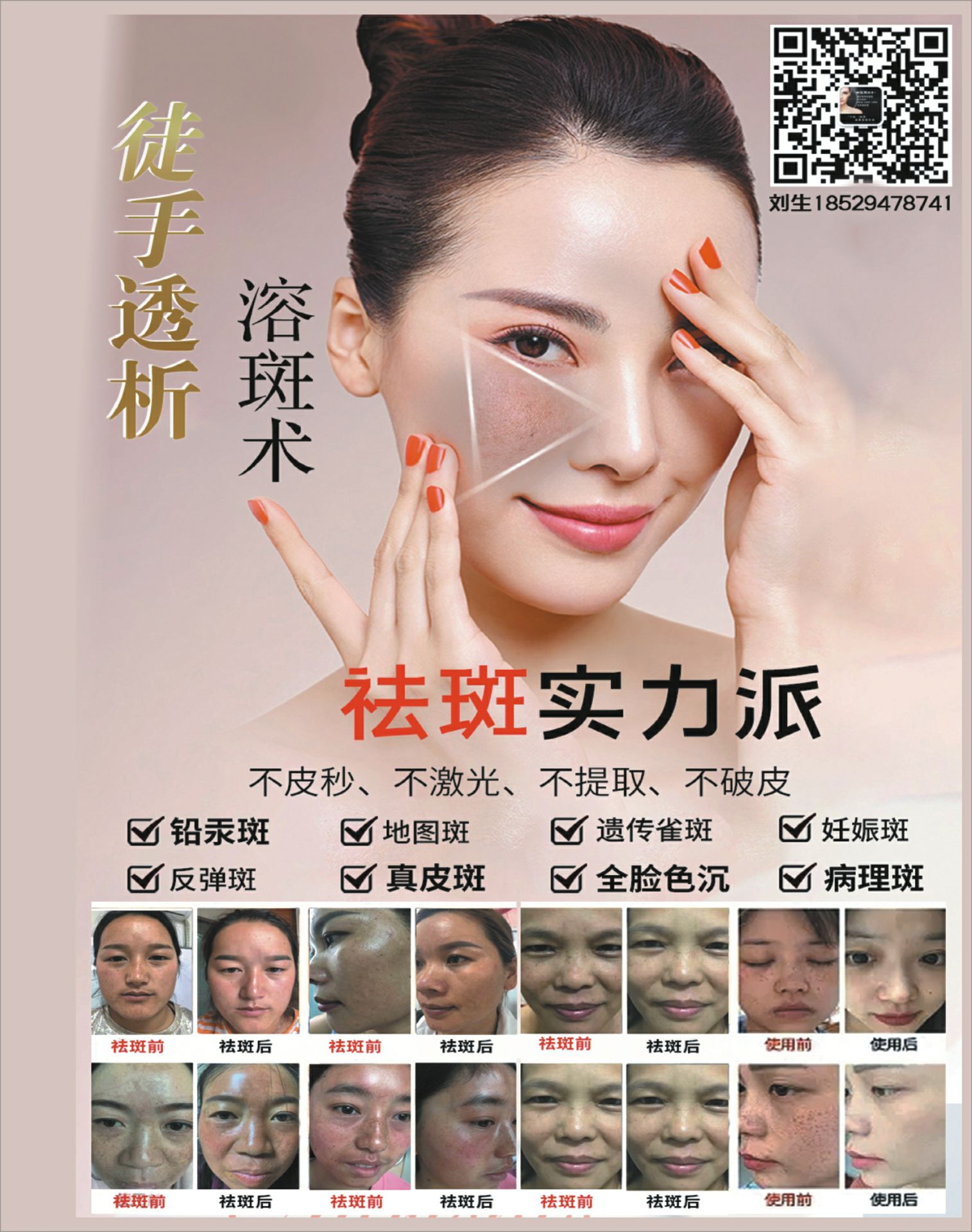 干细胞